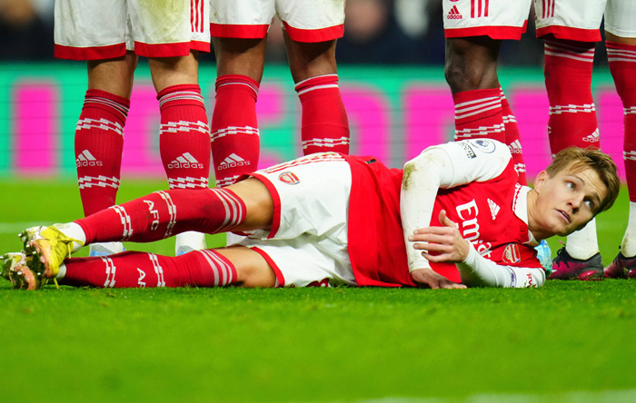 Arsenal vs. Manchester United Tipp